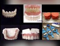 By purchasing this kit, you agree to our terms of service. Diy Partial Denture Kit Acrylic Resin Teeth A1 Missing Teeth Ebay