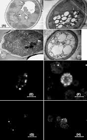 All structured data from the file and property namespaces is available under the creative commons cc0 license; Microscopic Evidence For The Increase In Peroxisomes By Download Scientific Diagram