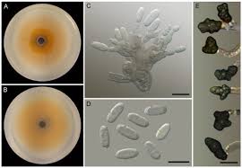 Image result for Colletoecema