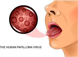 Image result for human papillomavirus symptoms