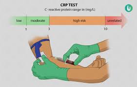 Your understanding of cpr online procedures and the correct way to perform cpr steps will be tested. Best C Reactive Protein Crp Test Lab Gujrat Pakistan Awami Lab