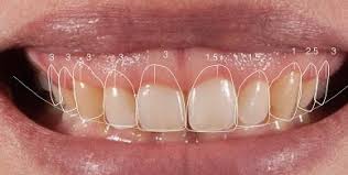 Gengivoplastia e gengivectomia