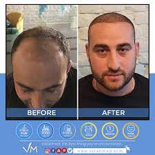 13 Days Later