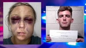 Norman Pregnant Woman Allegedly Attacked Twice By Boyfriend, DA Says Low  Bond Amount To Blame