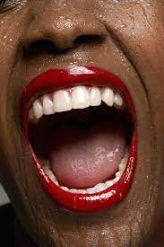 Sex headaches: severe headache when you orgasm