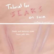 A blotchy red rash on the cheeks with groups of red papules. How To Wounds Scars Etc