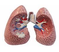 What is chronic obstructive pulmonary disease? Ù…Ø±Ø¶ Ø§Ù„Ø§Ù†Ø³Ø¯Ø§Ø¯ Ø§Ù„Ø±Ø¦ÙˆÙŠ Ø§Ù„Ù…Ø²Ù…Ù† Ø¹Ù„Ø§Ø¬ Ù…Ø±Ø¶ Ø§Ù„Ø§Ù†Ø³Ø¯Ø§Ø¯ Ø§Ù„Ø±Ø¦ÙˆÙŠ Ø§Ù„Ù…Ø²Ù…Ù†