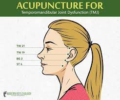 Pin On Acupuncture