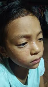 Anim na Pagkaing Kailangan Mong Ma-Consume Upang Alisin ang Nicotine sa  Iyong Katawan na Dulot ng Paninigarilyo Smoking is one of the most  addicting self-destructing wrongdoing that a person could ever have