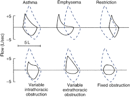 Pulmonary Function Testing Clinical Gate