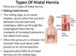 Hiatal Hernia