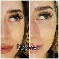 Bb glow serum is an excellent source of calcium, phosphorus, potassium, magnesium, manganese, zinc and zinc for use in all types of marine and looking for a good deal on bb glow serum? Bb Glow Behandlung In Bayern Regensburg Ebay Kleinanzeigen