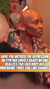 Cynthia Erivo Changing Shape of Head