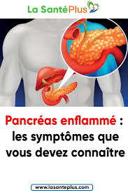 Pin On Astuces Sante