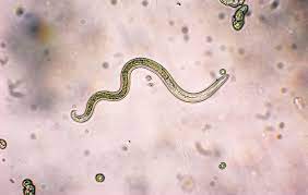 A helminth is a medical term for intestinal worms. On Facebook Fears Of Parasites Push People To Post Pictures Of Feces And Pursue Dangerous Remedies