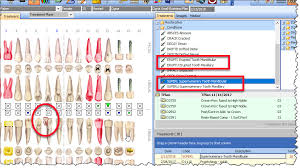 11 Rare Tooth Disorders And Their Icd-10 Codes