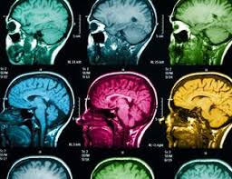 Ct scans are also referred to as computerized axial tomography. Ct Scan Side Effects Risks Of A Ct Scan