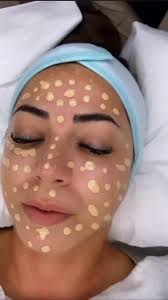 ✨ ISMERD MEG A BB GLOW KEZELÉST! ✨, Álmodtál már arról, hogy smink nélkül  is tökéletes legyen a bőröd? A BB Glow kezelés ezt valósággá teszi!, 🌸 Mi  a BB Glow?, A legújabb koreai szépségápolási ...