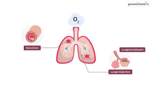 The heart failure milieu clinical presentation. Chronisch Obstruktive Lungenerkrankung Copd Vorbeugung Symptome Und Behandlung Gesund Bund De