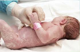 Relationship Based Care For Newborns With Down Syndrome And Endocardial Cushion Defect Nursing For Women S Health