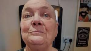 Forest's Norma braves the shave for Cancer Research UK