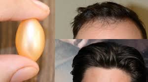 Hair Restore Biotin Hair Growth Serum In Hindi Vitamin E Hair Growth Serum Vitamin E Capsule For Fast Hair Growth Youtube Vitamin E Hair Hair Growth Faster Hair Growth Serum