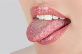 Я предпочитаю именно эти духи. Morsures De La Langue Symptomes Traitement Definition Docteurclic Com