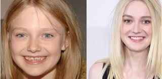 However, you need to remember when you look at celebrities with braces before and after, it will help you to move forward with your own treatment plan. Celebrities And Braces Ea Smiles Winter Haven Bartow Orthodontistea Smiles Blog