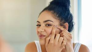 Jun 15, 2021 · meredakan radang dan gatal. 17 Cara Menghilangkan Jerawat Secara Alami Efektif Dan Tanpa Efek Samping Bagi Wanita Dan Pria Lifestyle Liputan6 Com