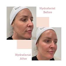 ملف ‏‎Enhance Cosmetic Injectables‎‏ الشخصي‎