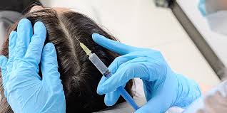 For 1/10th the cost, this treatment is known to initiate hair growth in affected areas. Best Hair Regrowth Treatment Prp Vs Stem Cell Vs Mesotherapy Vs Transplantation
