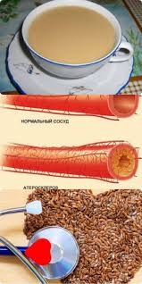 как почистить сосуды в домашних условиях быстро и эффективно Kak Ochistit Sosudy S Pomoshyu Semyan Lna S Izobrazheniyami Zdorove Produkty Dlya Zdorovya Travolechenie