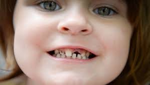 Shattered smiles: Florida kids face dental crisis