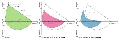 Pulmonary Function Testing Amboss