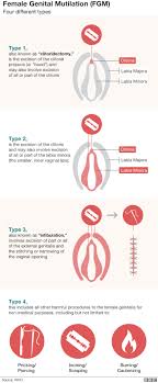 Type iii is the extreme type of fgm. Uganda Fgm Ban Why I Broke The Law To Be Circumcised Aged 26 Bbc News