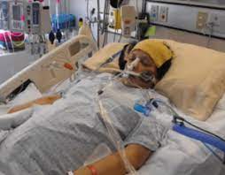Gbs does not affect the cns, so thinking is not affected. A Review Of Guillain Barre Syndrome Microbewiki