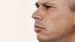 Clear need for bright idea