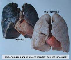 Menariknya, penelitian juga menemukan bahwa tanaman ini bisa digunakan sebagai cara berhenti merokok secara alami. Dinas Kesehatan Provinsi Banten Pengertian Merokok Dan Akibatnya
