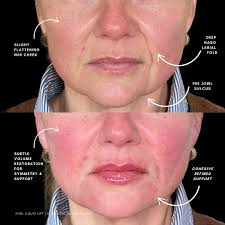 She wasn't sure, but now she's a believer 🙌 (don't miss the ending)— When  she took the leap to start her journey of reclaiming her confidence with  me, there were lots of