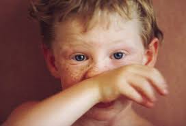 Childhood Diseases Measles Mumps More