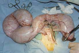 Maybe you would like to learn more about one of these? Surgery Of The Male And Female Reproductive Tract Iv Seminars