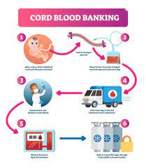 Donating cord blood is free, and public cord blood banks pay for collection and storage. Home Banking Umbilical Cord Blood