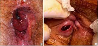 Annals of Coloproctology
