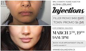 TOMORROW 🎉✨ Alisha Leblanc will be at Reveal Medi Spa this March 5th &  19th from 9am-3pm! SPECIAL INJECTIONS PROMO: Filler $450 (regular $550) and  Toxin for $6 (regular $8) 👄