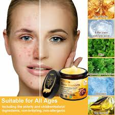 Ally Bee's Instagram, Twitter & Facebook