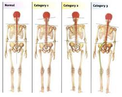 Pin On Optimum Health