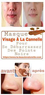 Pin On Soin Du Visage