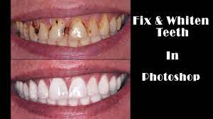I've been using spot healing brush tool with the mode as lighten but its making them look very glossy. How To Whiten Teeth In Photoshop Fix Teethwalls