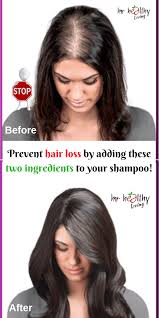 The ultimate guide to hair loss treatment post menopause & how to recover by stacey biro. Pin On Health
