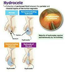 Pin By Niloufer Sultana On Surgery Medical Mnemonics Pediatrics Medical